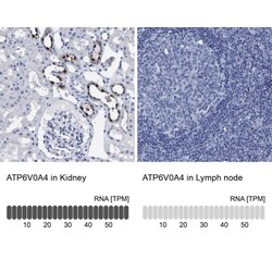 ATP6V0A4 Antibody, Novus Biologicals:Antibodies:Primary Antibodies